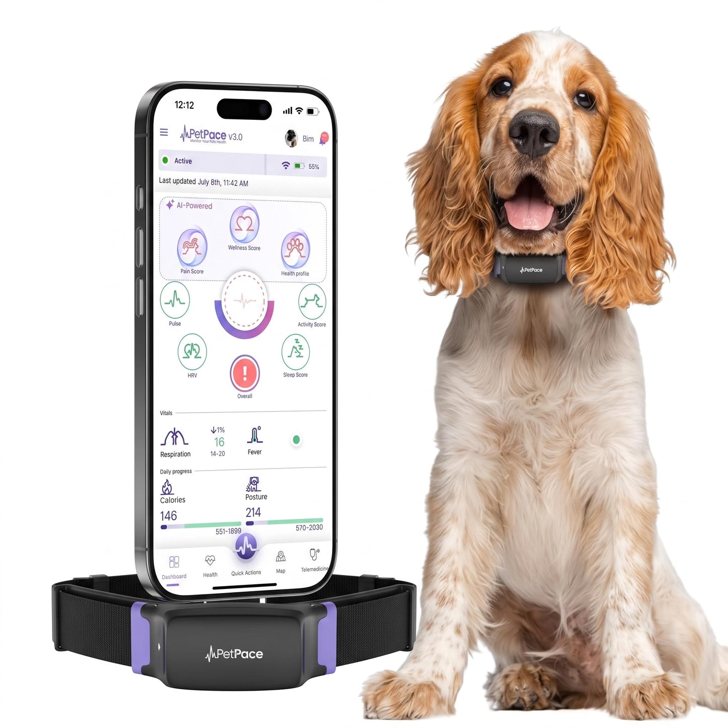 AI Dog Health Collar with Vital Signs, GPS & Vet Sharing